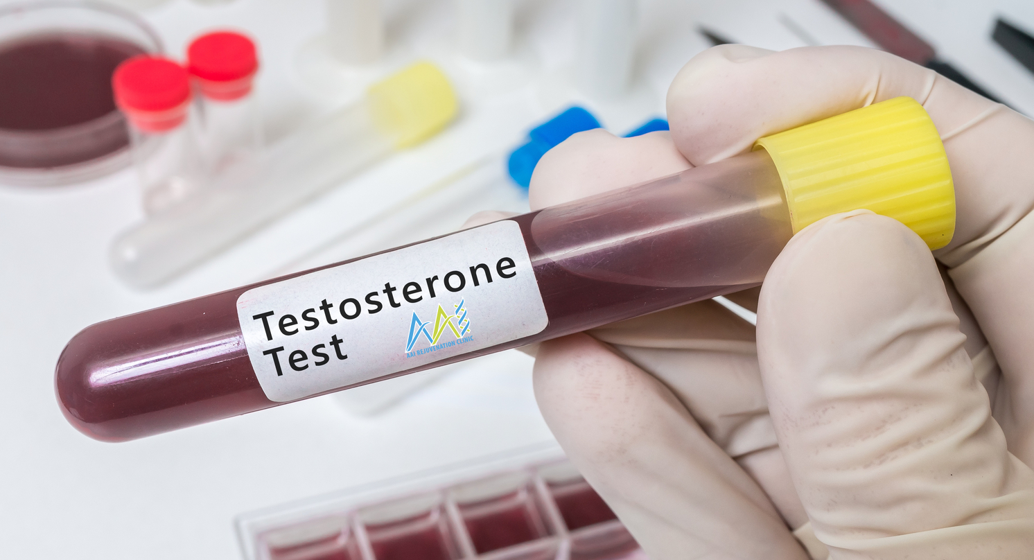 testosterone-test